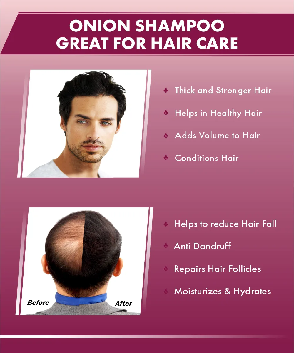 Urbangabru Onion Shampoo - Image 6