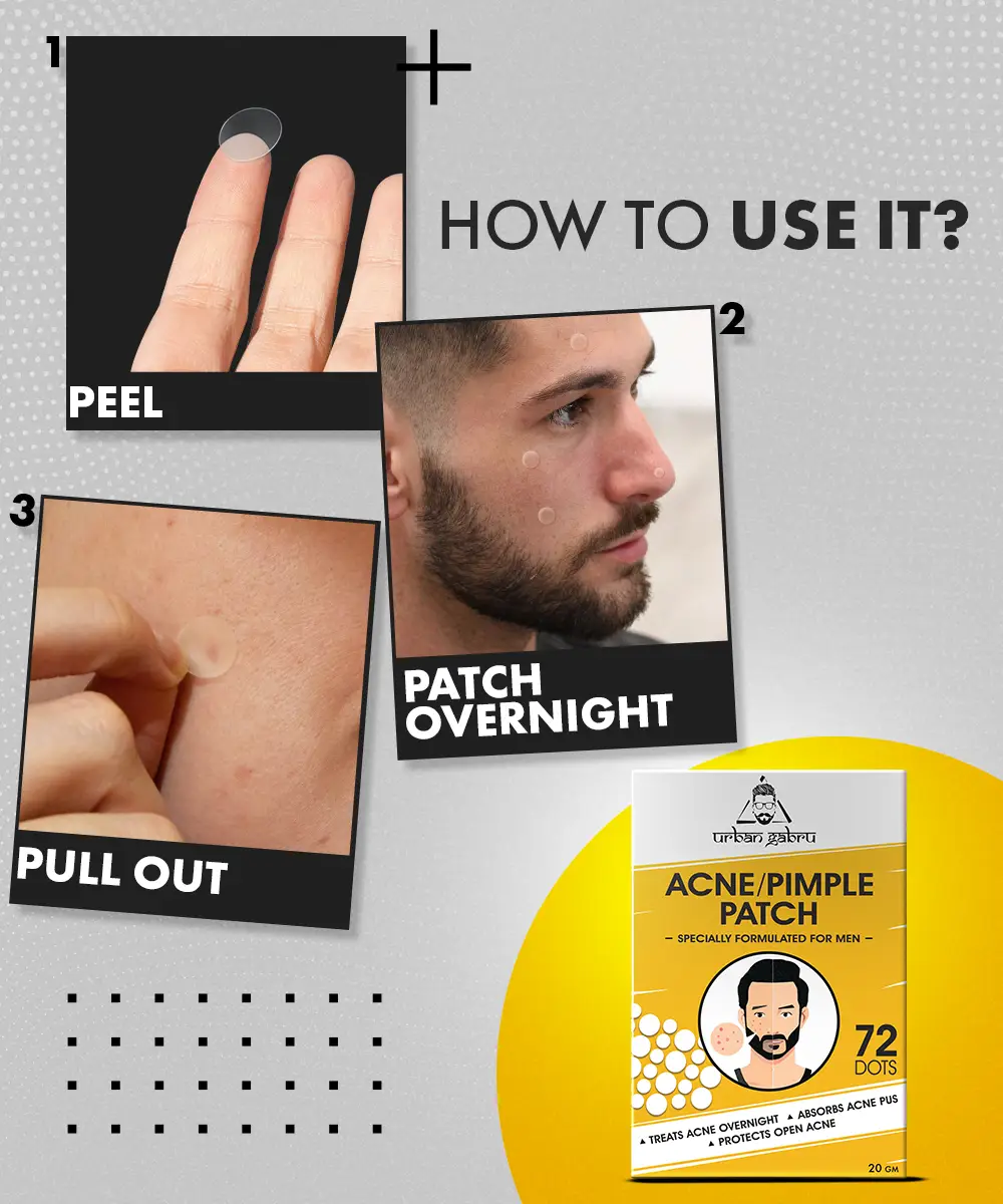 Urbangabru Acne Pimple Patch - Image 5