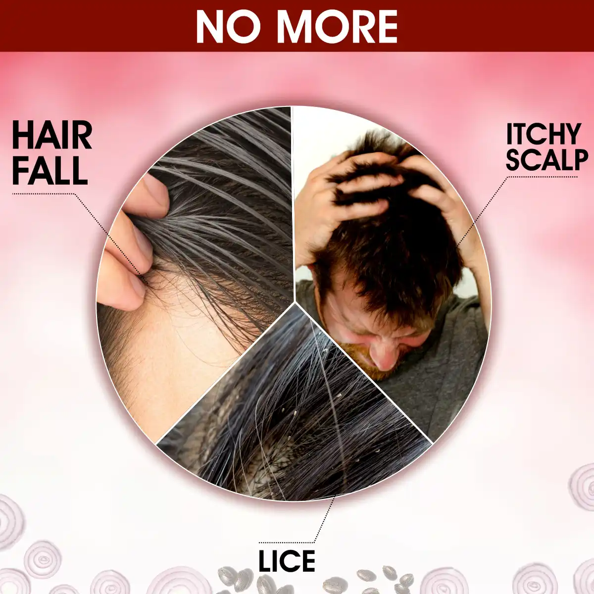Urbangabru Hair Fall Care Combo - Image 4